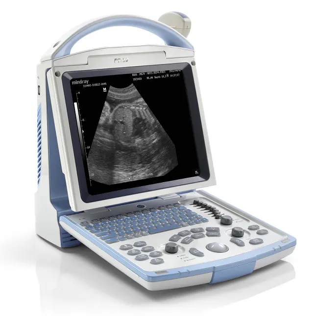 Diagnostic Ultrasound System Full Digital Portable B/W Ultrasound Machine for Hospital