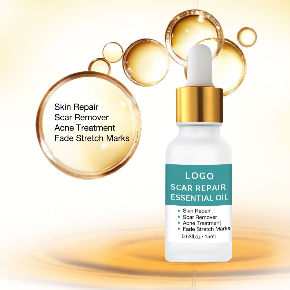 Youth repair essential oils fade acne scars and skin scars repair essential oil