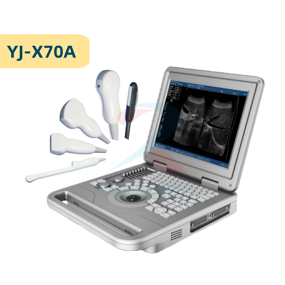 FORERMED LCD Ultrasound Scanner diagnostic medical sonographer ulltrasound