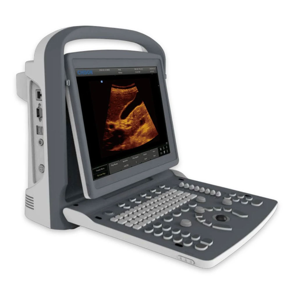 Versatile B/W siterite vascular ultrasound machine chison eco 2 vet