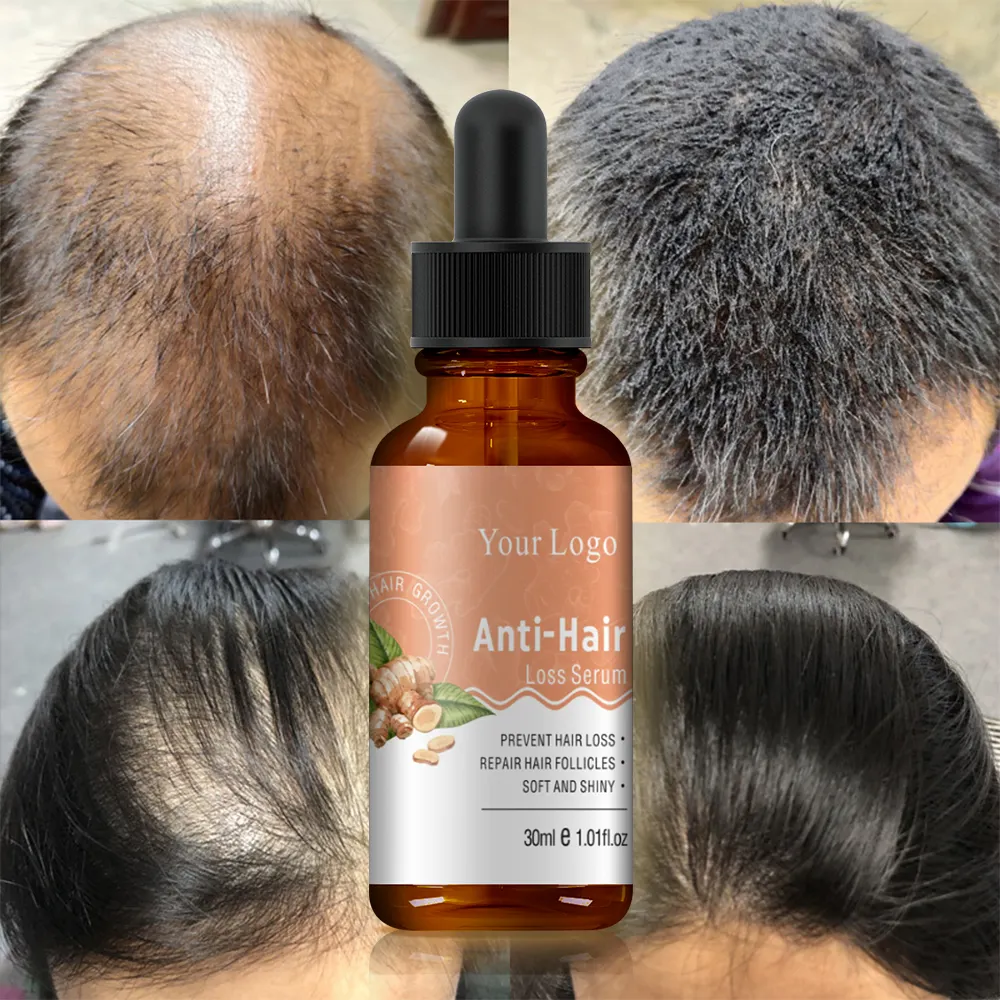OEM Natural Organic Ginger Oil Hair Growth Treatment Anti Loss Hair Growth Serum For Anti Hair Fall
