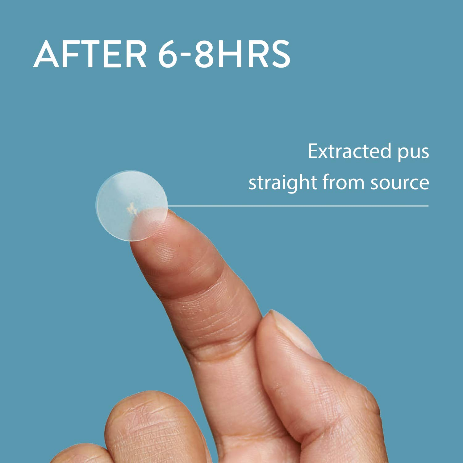 Absorbing cover patch waterproof skin tag acne remover patches with eco friendly packaging