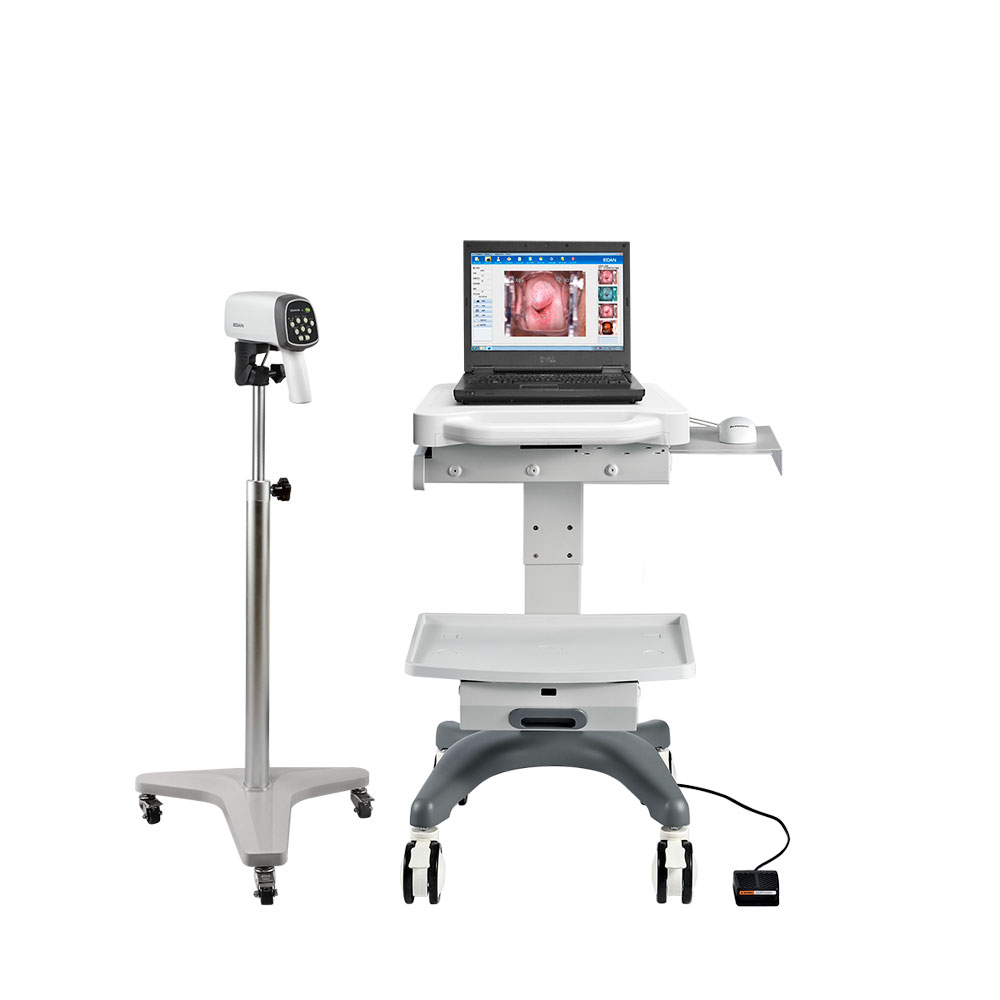 Оригинальное HD видео Colposcope EDAN C3A C6A цифровое видео colposcopio edan colposcope производители