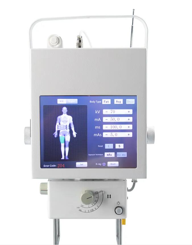 MY-D019D-N 5.3KW Digital Portable Medical Xray Radiology Machine Mobile Digital X-ray Equipment Portable X Ray Machine