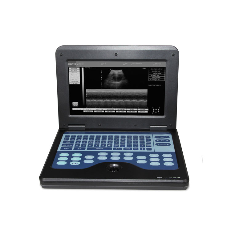 Недорогой сертификат CONTEC CMS600P2 доплеровский ультразвуковой аппарат, портативное ультразвуковое диагностическое устройство