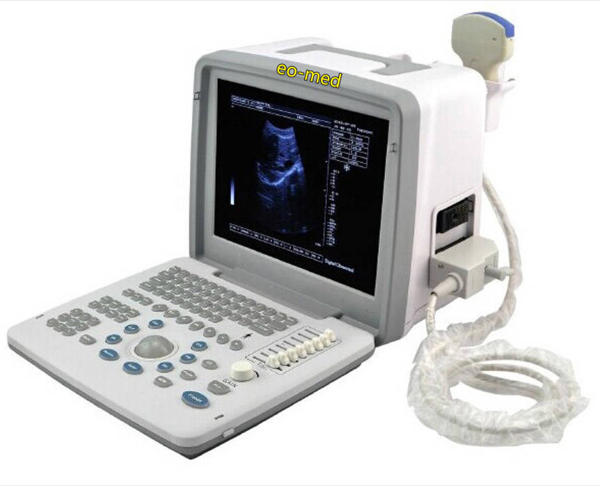 Hospital Portable Ultrasonic Devices Ultrasound Machine Medical Ultrasound Instruments BW300