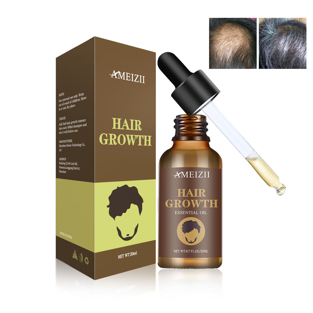 Частная этикетка Сыворотка для роста волос натуральный имбирь Aceites Esenciales Soin Cheveux отрастания волос лечение выпадения волос масло для женщин
