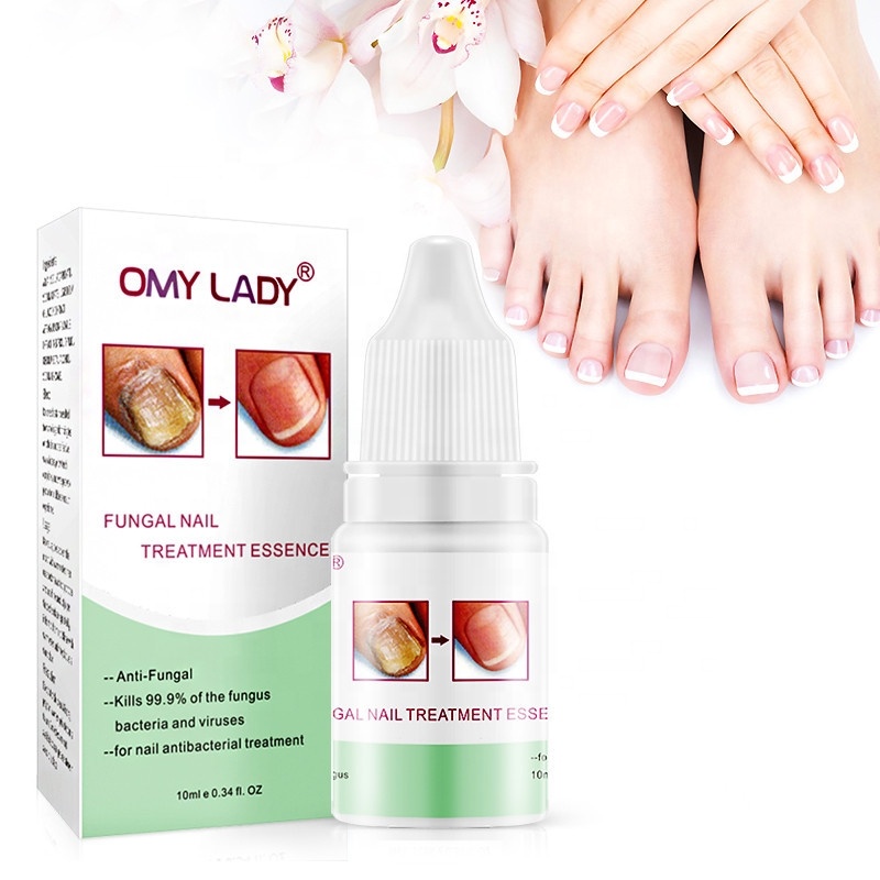 Высококачественный Лечебный крем для ногтей OMY LADY, восстанавливающий крем для ногтей, раствор для ухода за ногтями