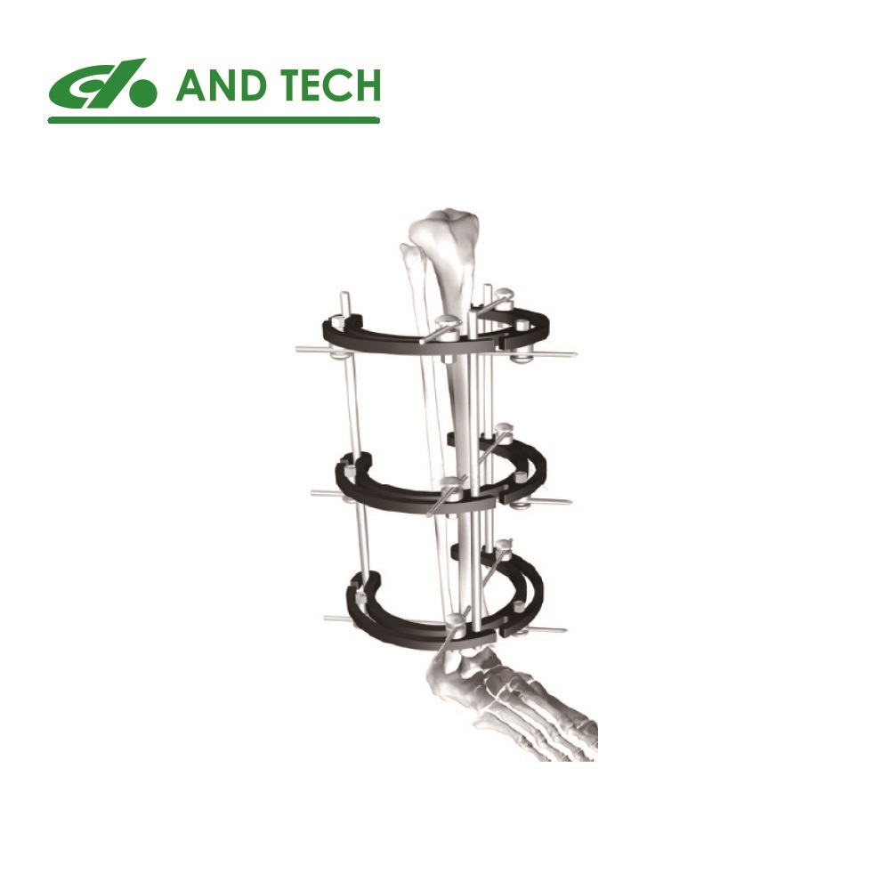 Ilizar ove orthopedic surgical instruments device bone facture fragment external fixator with ring