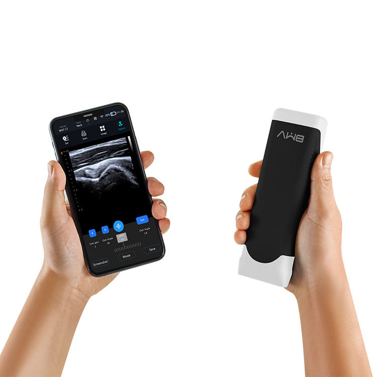 Ultrasonic, Optical, Electronic Equipment BMV New Medical Wireless Ultrasound Probe Wifi Medical Ultrasound Instruments