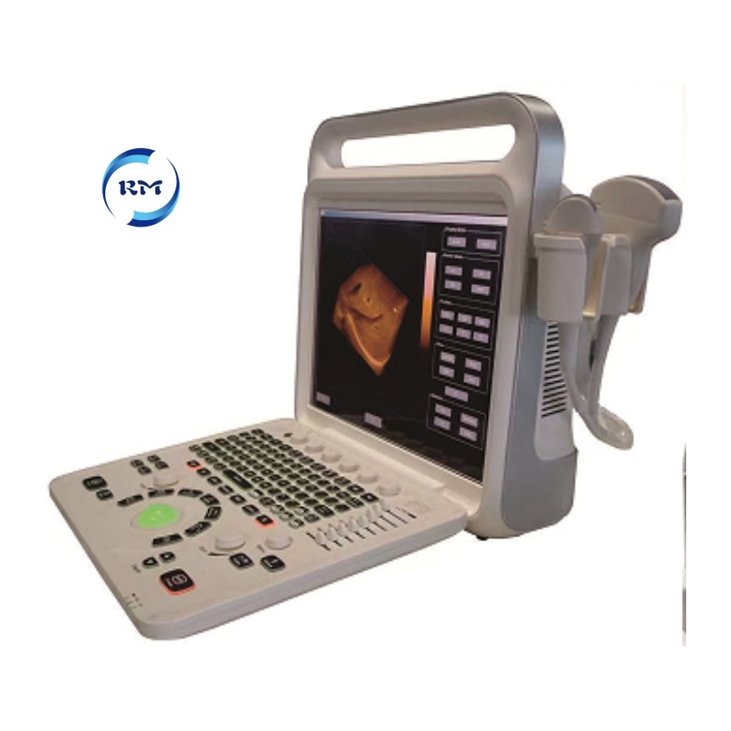 Factory Price Hot Selling Diagnostic Ultrasound Scanner 3d Color Portable Medical Doppler Machine for Hospital Clinic
