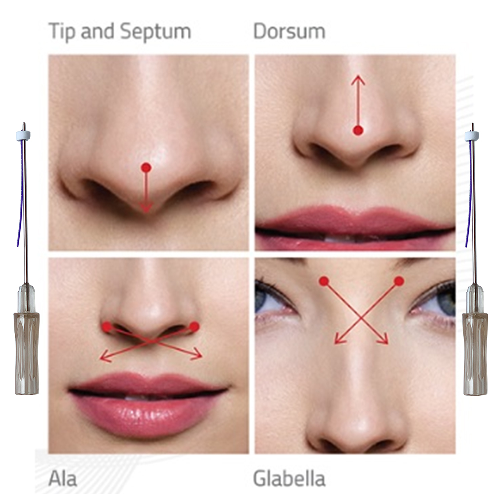 2021 hilos pdo dermaprime fio pdo nose lift pdo thread nose L Blunt 19G38mm bonetta can use dermal filler