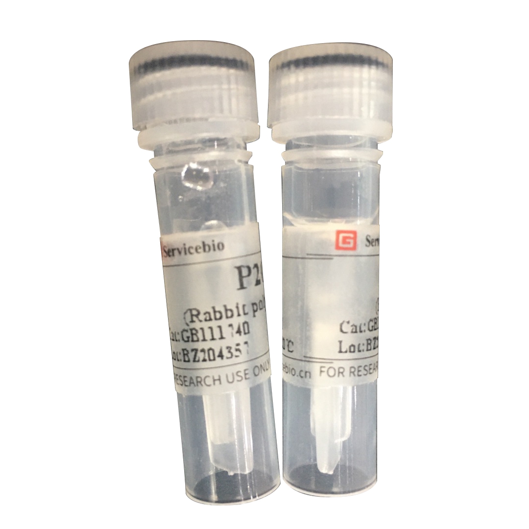 Primary Antibodies Polyclonal Antibody Anti-p53 Rabbit biotechnology laboratory GB111740
