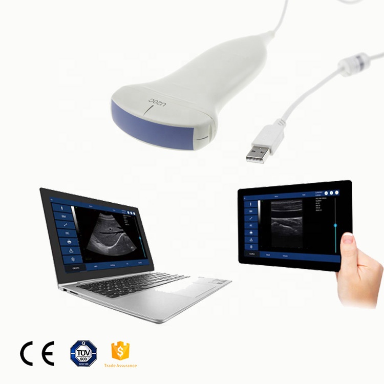 GYGN-CE утвержден легко носить с собой U20C выпуклые USB портативная ультразвуковая машина, которая позволяет диагностировать более удобен