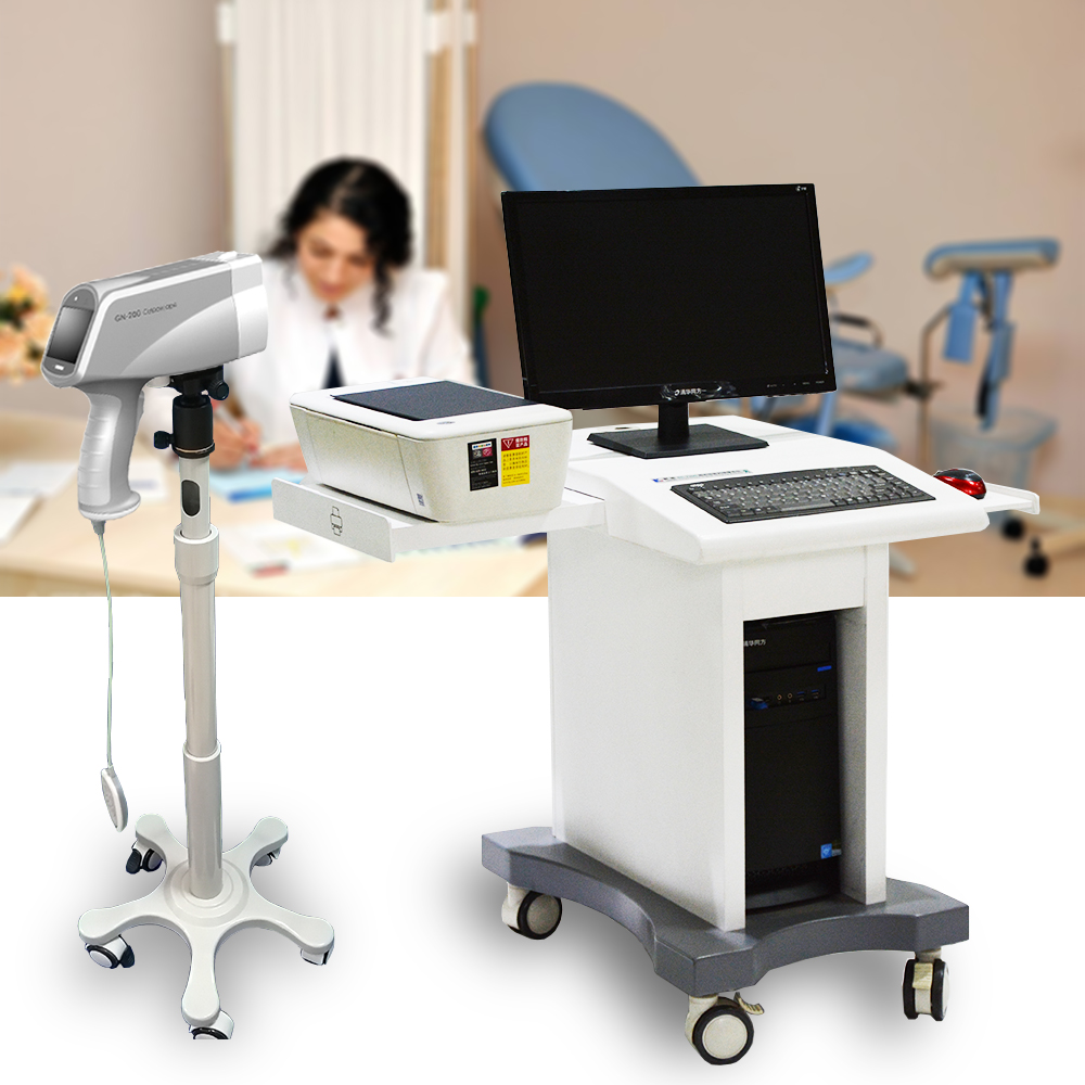2020 best selling ce approved digital video vagina colposcope 2. M resolution portable colposcopy for gynecology test