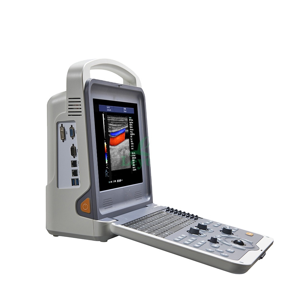 LTUB01 Medical Volume Probe Portable Color Diagnostic Ultrasound Machine With Built-In Battery