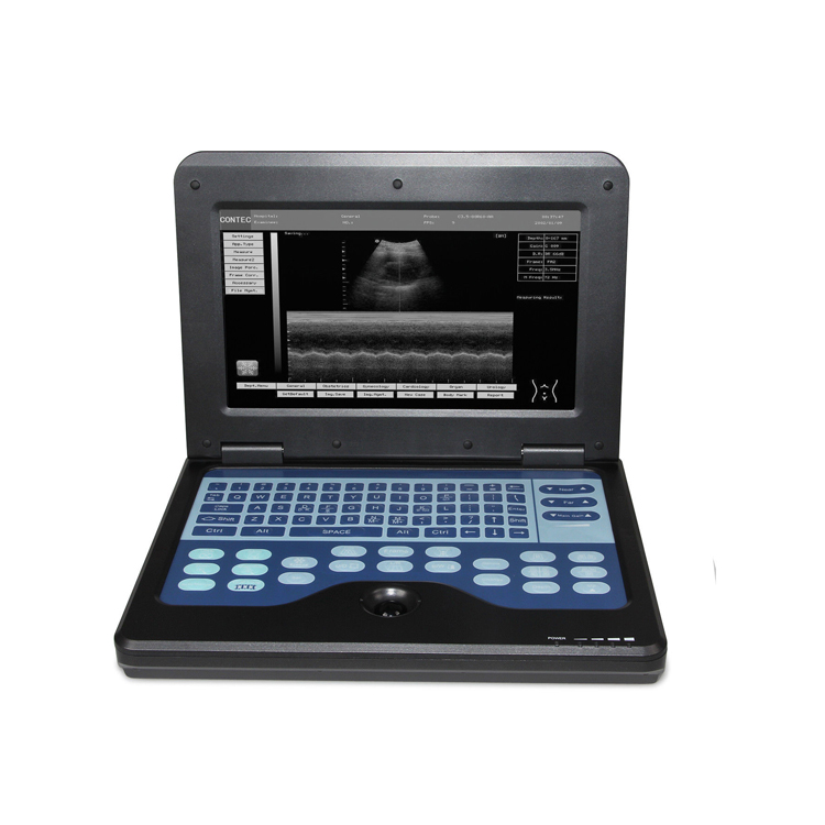 CONTEC CMS600P2 10,1 дюймов цифровой недорогой ноутбук портативный доплеровский ультразвуковой аппарат цена
