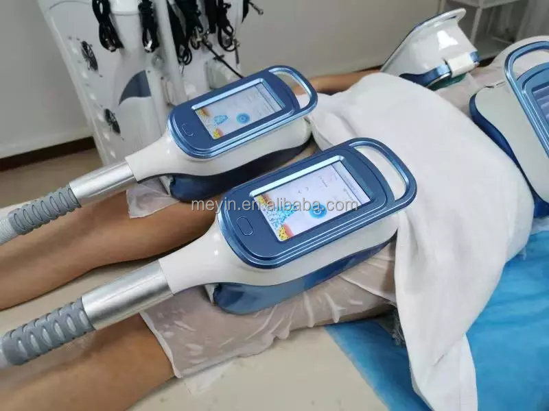 antifreeze membranes criolipolisis cryolipolysis antifreeze membrane