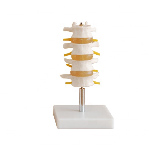 Human Lumbar Set (4 pcs) PVC material school medical teaching training model BC1025-18