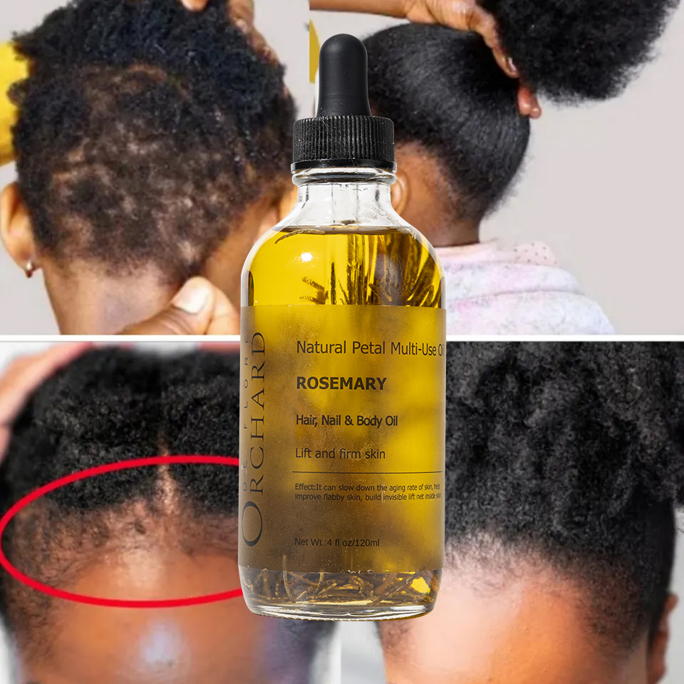 Best Selling Natural Organic Rosemary Essential Oil For Hair Care,Anti Hair Loss Repair Rosemary Oil For Hair