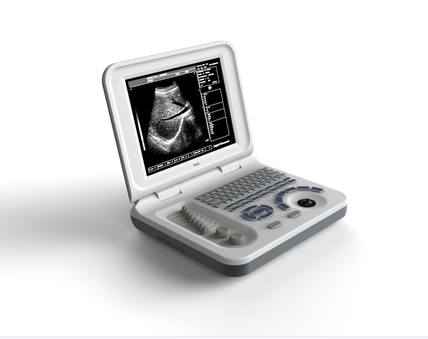 budget chinese Ultrasound Scanner doppler 10 inch Ultrasonic machine cardiograph S30 LED lumify Ultrasound Scanner scan