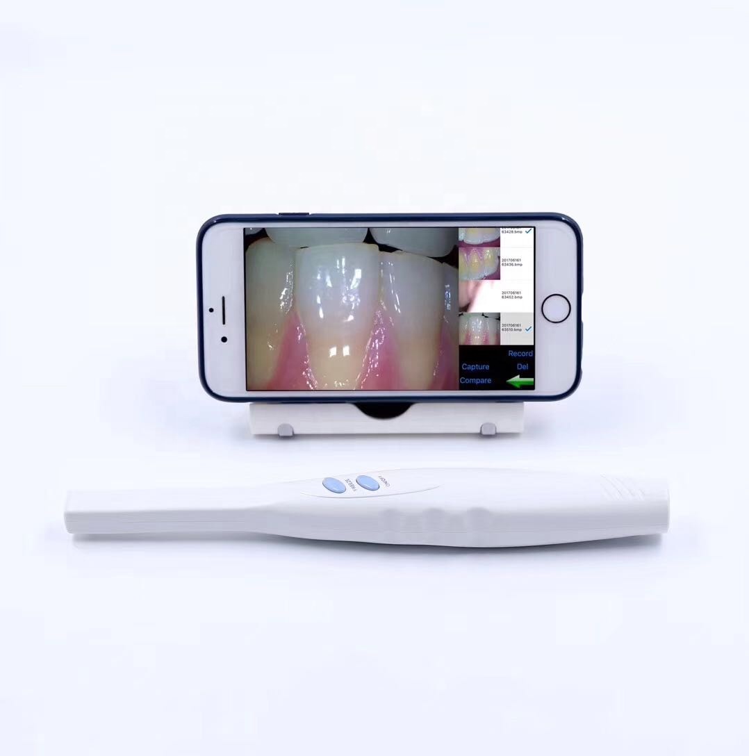 2021 High Quality USB Dental Intraoral Camera/ Intra Oral Camera