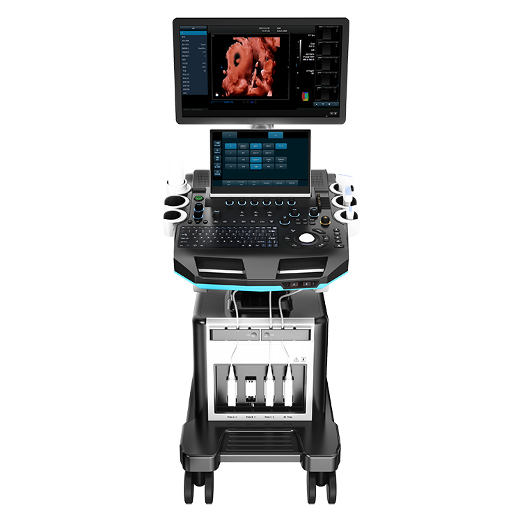 UCD50T Obstetrics Baby Scan Diagnosis Human Color Hearth Trolley 5D Ultrasound Machine