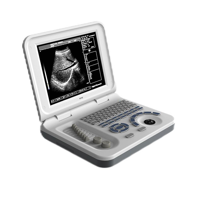 Chenwei 10.4 Inch Full Digital Ultrasound Diagnostic System ISO & CE Approved S30 Color LED Display Ultrasound Scanner