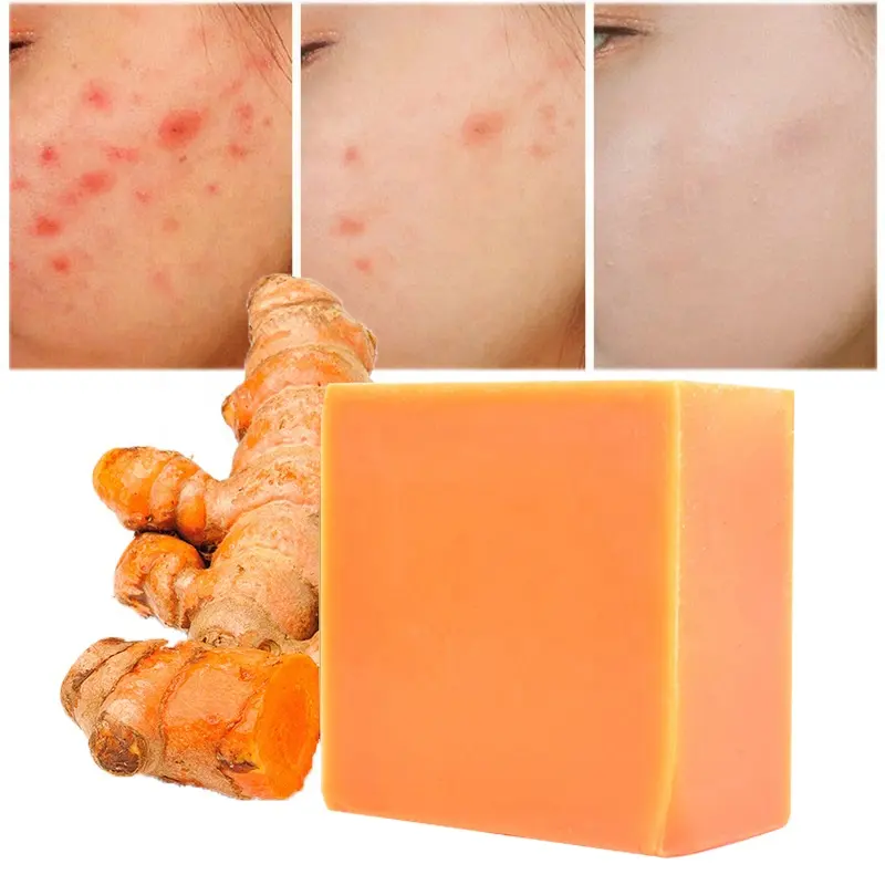 2021Hot Sales Private Label Organic Toilet Bath Soap Bar Handmade Soap Whitening Antiseptic Remove Acne Turmeric Soap