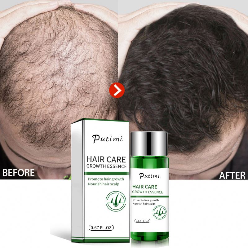 Natural Plant Women Men Treatment Hair Loss Serum Hair Serum Growth Anti Hair Loss Serum