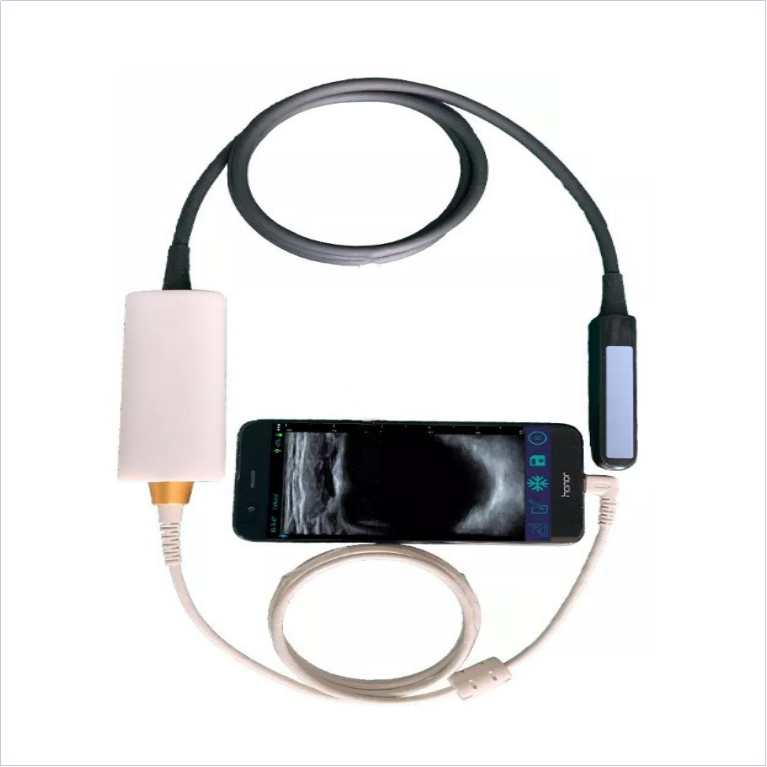Медицинский портативный Ректальный ультразвуковой зонд USB Type C, ультразвуковой преобразователь, мини-сонар, ультразвуковой сканер