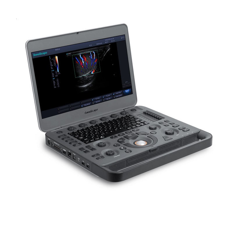 CE ISO SonoScape x5 портативный ультразвуковой аппарат, допплер ультразвуковой SonoScape X5 портативный USG
