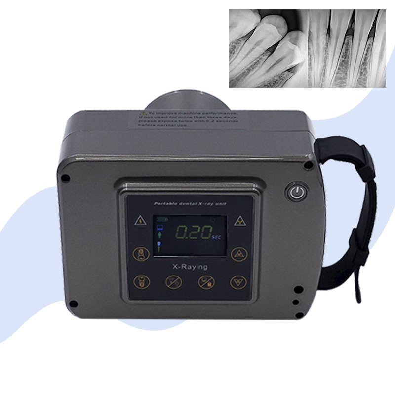60KV High Frequency Dental X-ray Unit Portable Digital Medical Radiology X ray Machine Clinic Dental Equipment