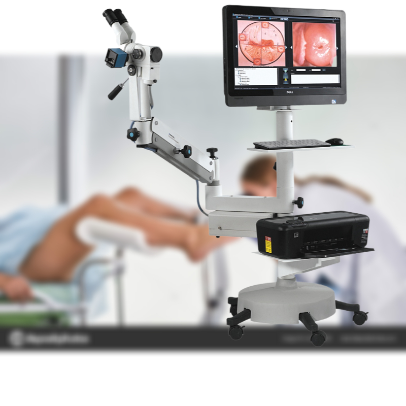 Kernel KN-2200BII Medical CE Removable Optical Colposcope for Vagina and Vulva Handheld Colposcopy Gynecology