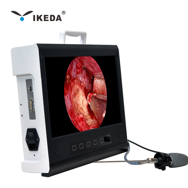 Veterinary Full HD Endoscopy Camera for Ear Nose & Throat