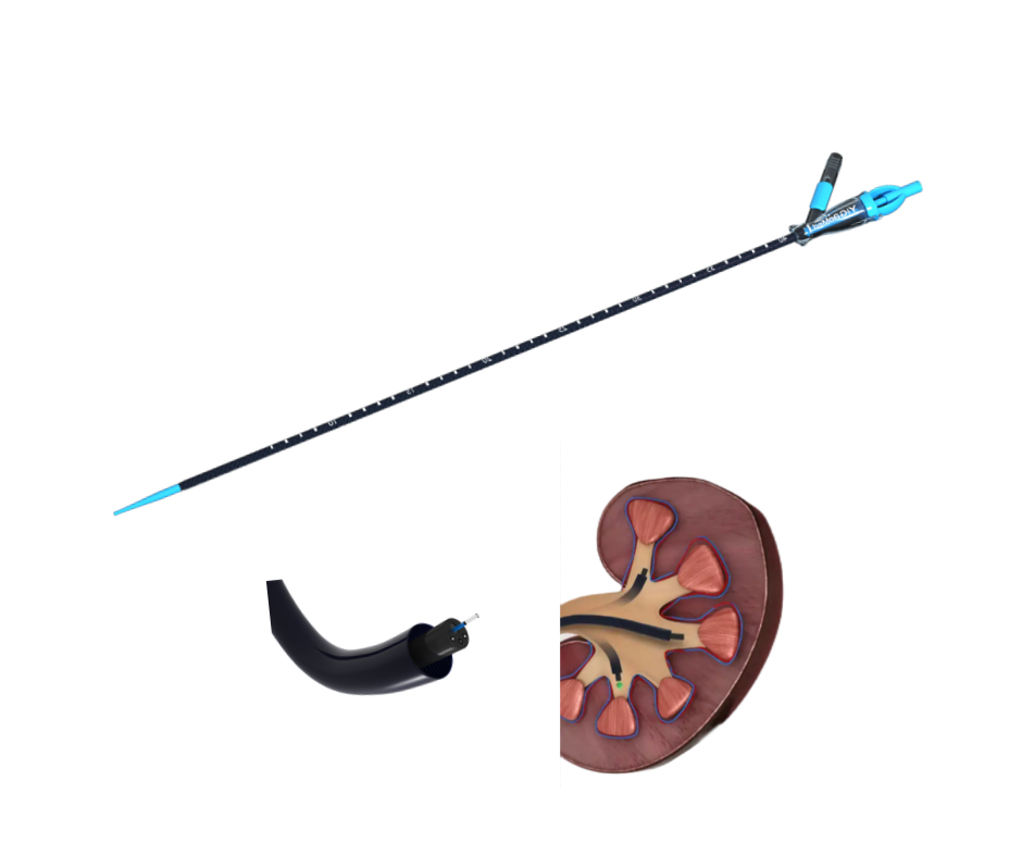 Flexible Navigable Suction Ureteral Access Sheath with Tip Disinfecting Type EOS