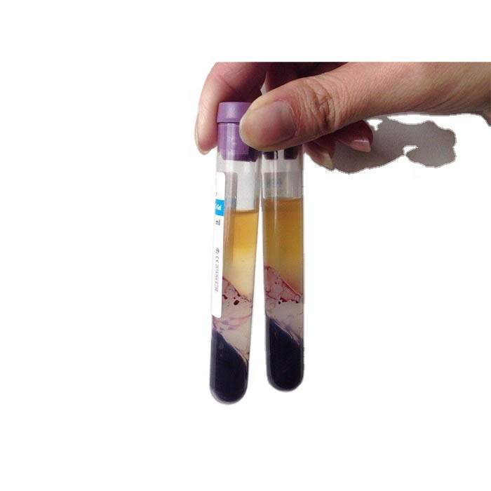 MY-B072E-2 Cosmetology platelet rich plasma blood collection 8ml PRP tube with acd gel and anticoagulant