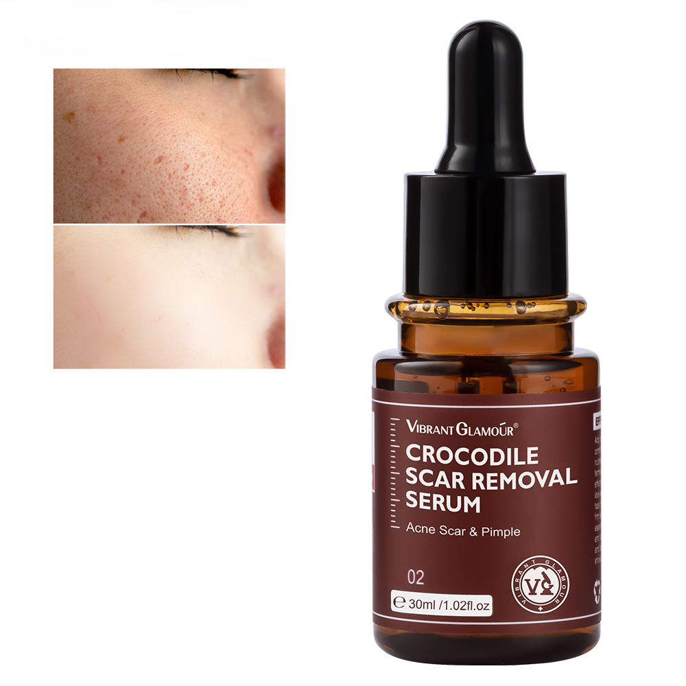 VIBRANT GLAMOUR Crocodile Scar Repair Serum Pimples Stretch Marks Face Gel Remove Scar Repair Serum