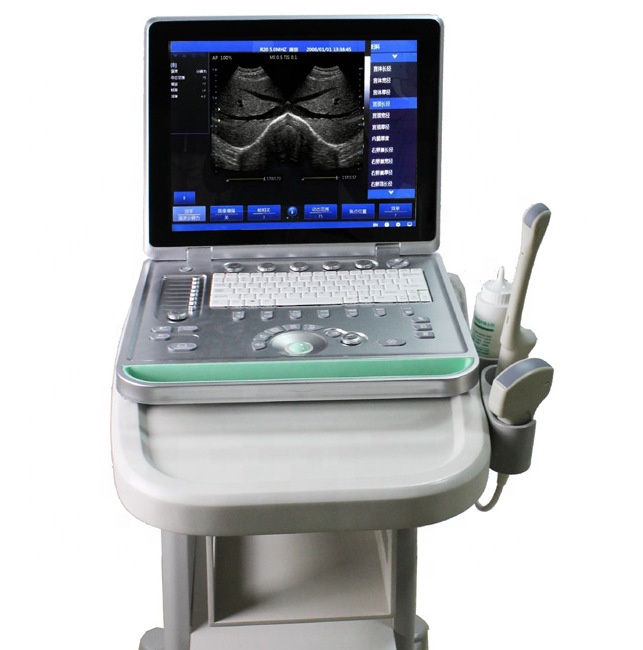 medical ultrasound instruments echo machine color doppler ultrasound system