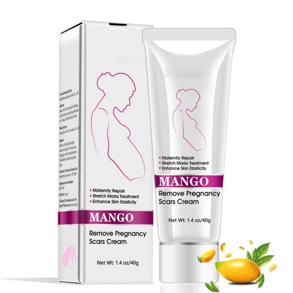 Wholesale Mango Stretch Mark Cream For Pregnancy Repair Scar Slack Line Abdomen Stretch Marks and Scar Removal Cream