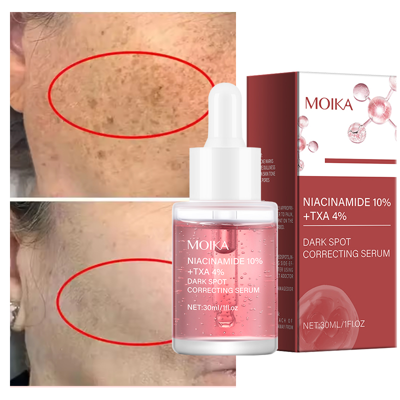 10% Niacinamide 4% Tranexamic Acid Serum Liquid Whitening Dark Spots Correcting Serum for Sensitive Skin