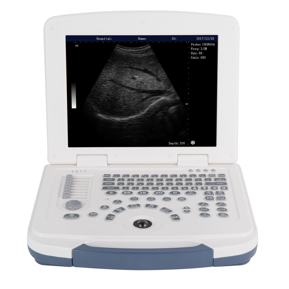 Expert Portable Chinese Factory Supplies CE ISO Approved High Quality Color Ultrasonic Diagnostic Apparatus for Hospital Use