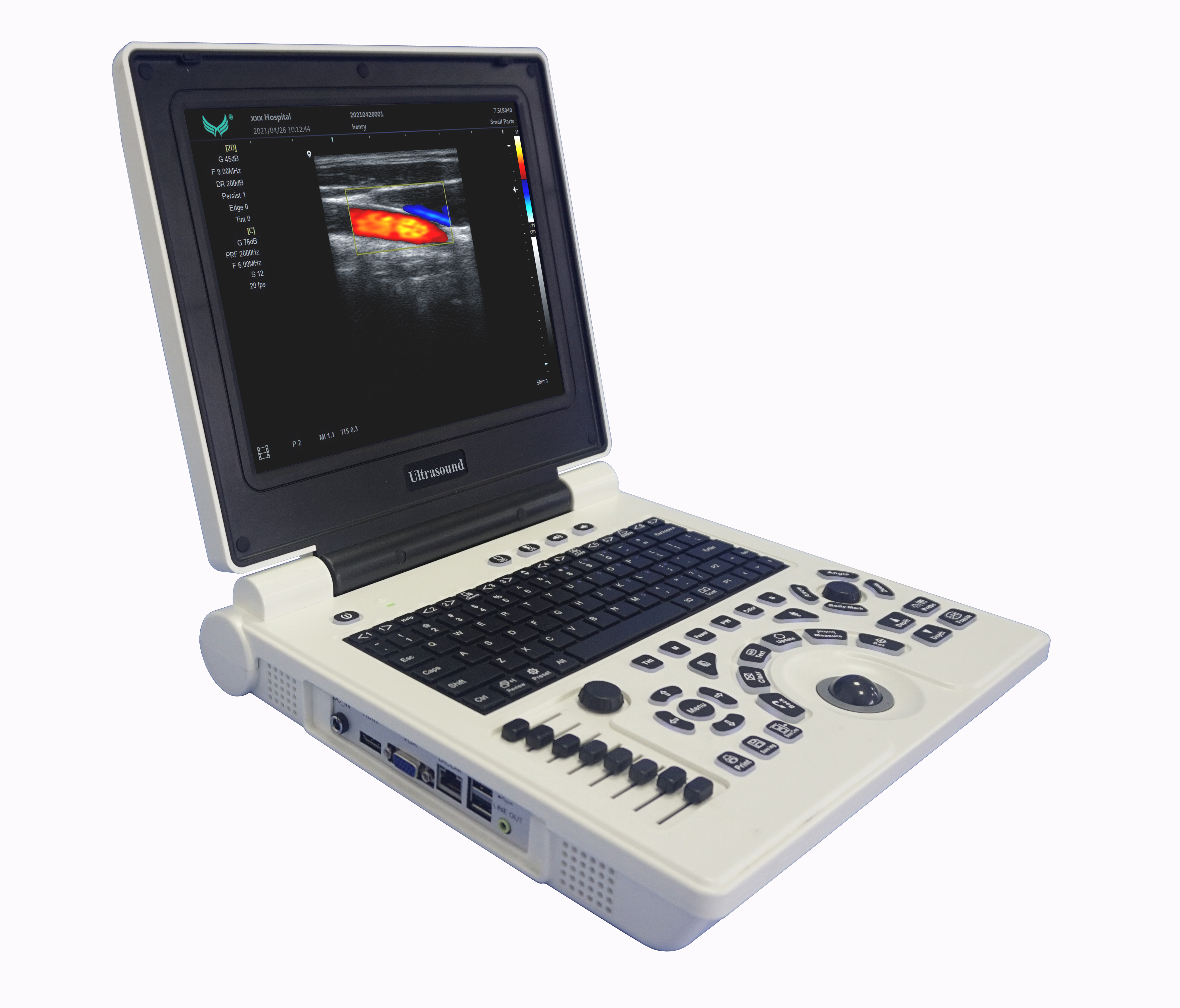 Chison economical portable color doppler ultrasound scanner