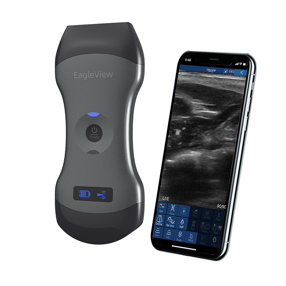 Weleaglue leview двойная головка портативный сканер медицинский ветеринарный допплер ультразвуковой ветеринарный