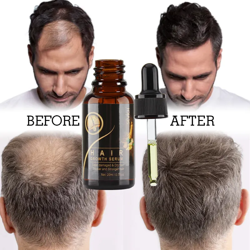 Private Label Organic Smoothing Repairing Hair Care Treatment Anti Loss Regrowth Scalp Elixirs Hair Growth Oil Serum