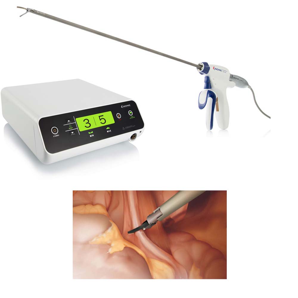 Surgical Instruments Ligature Vessel Sealing And Cutting Device Ultrasonic Scalpel System