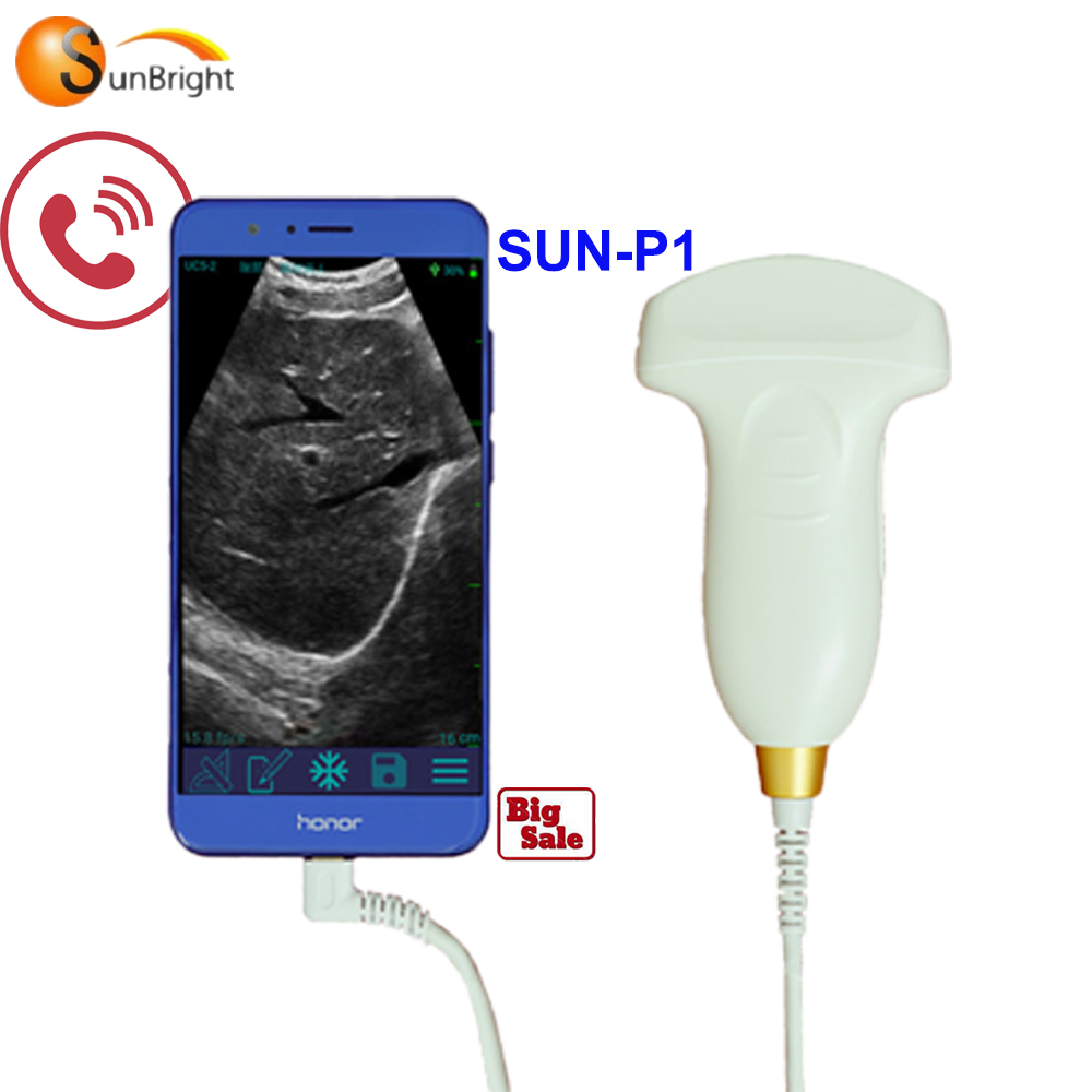 Digital Ultrasonic Diagnostic System USB Convex Probe SUN-P1