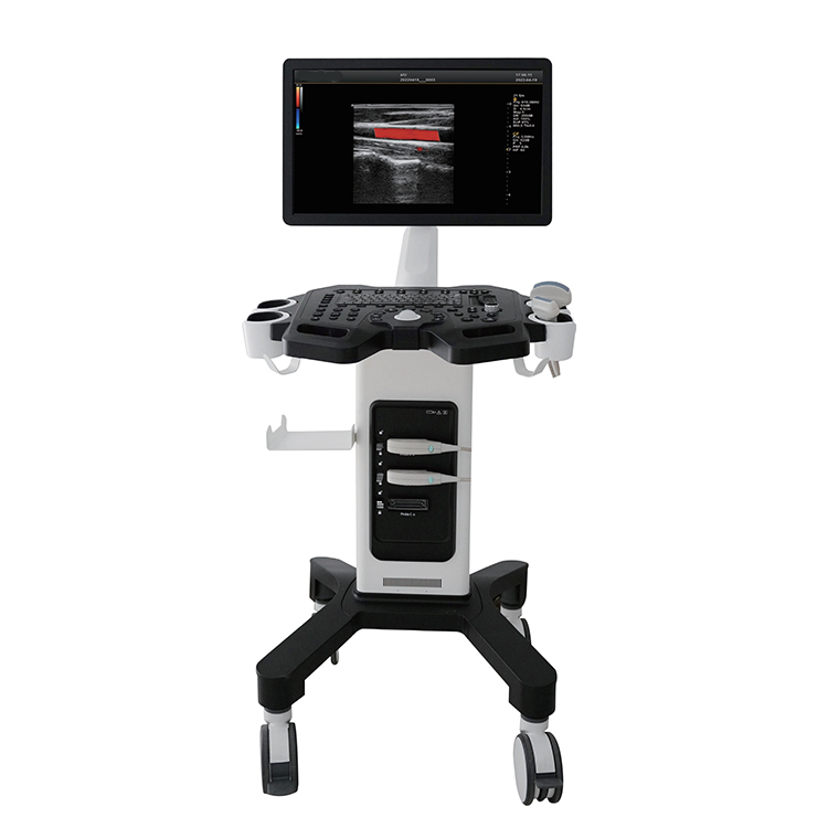 UCD3F China Mobile Cardiology Obstetric Diagnosis Color Ultrasound Scanner Machine Price