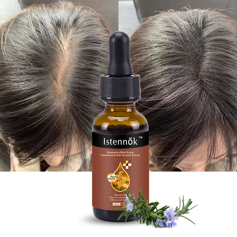 Istennok Repairing Anti Loss Regrowth Mint Scalp Elixirs Treatment Private Label Ginger Rosemary Hair Growth Oil Serum 30ml