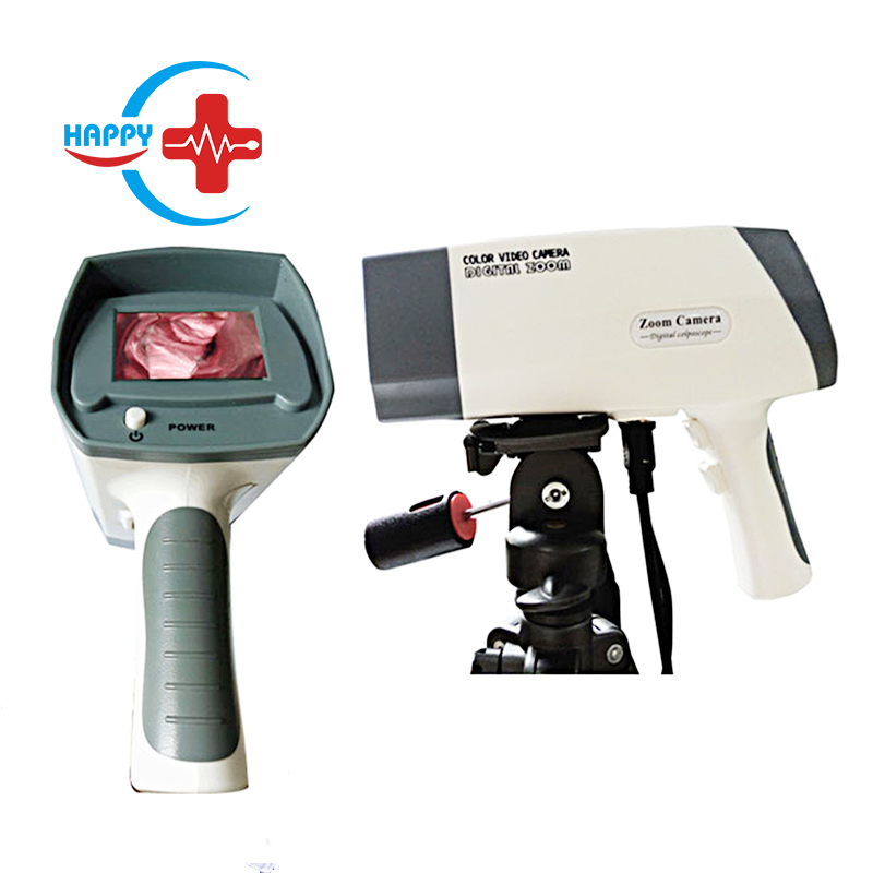 HC-F003 Ручной Электронный Colposcope/портативный цифровой colposcope